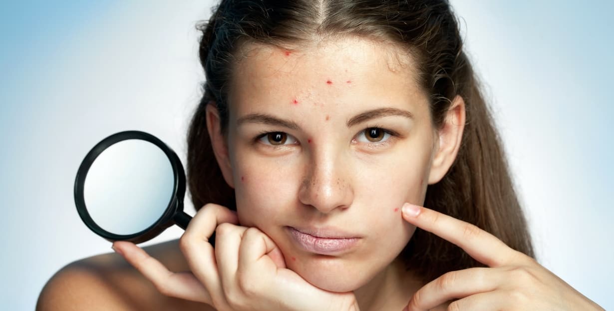 How Hormones Affect Your Skin and What You Can Do About It